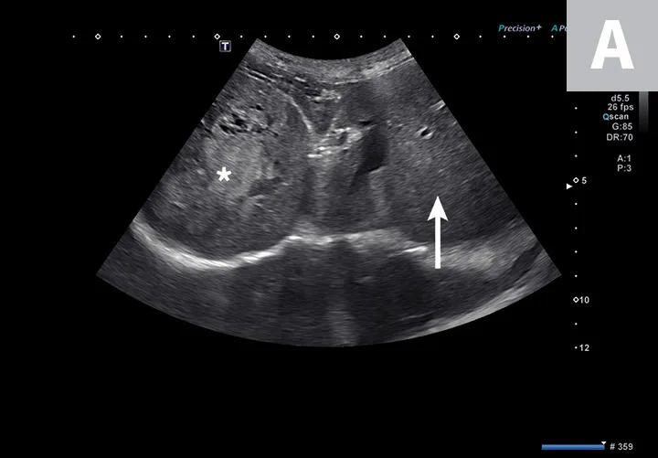 Two ultrasound images showing a hyperechoic mass in the liver and a hypoechoic mass in the spleen of a dog.