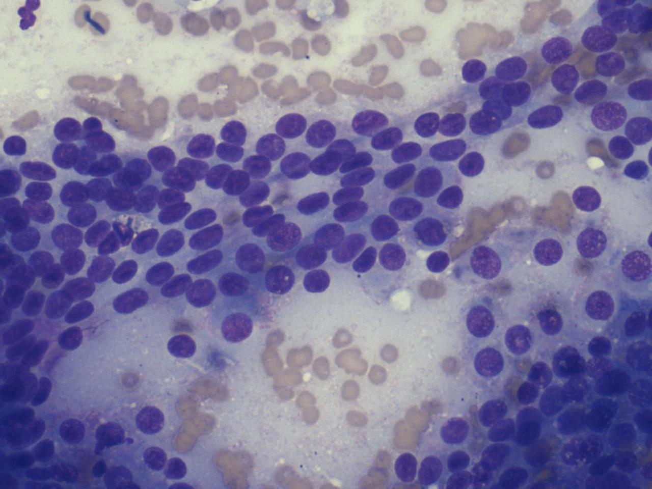 Microscopic image of cells from an anal sac tumor.