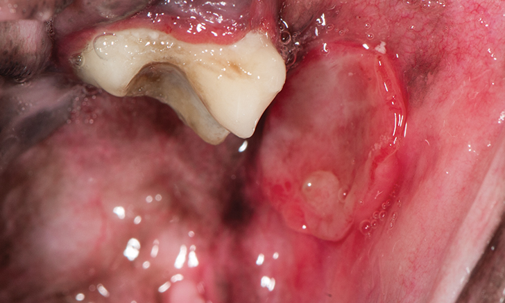 Mouth ulcer cat clearance treatment