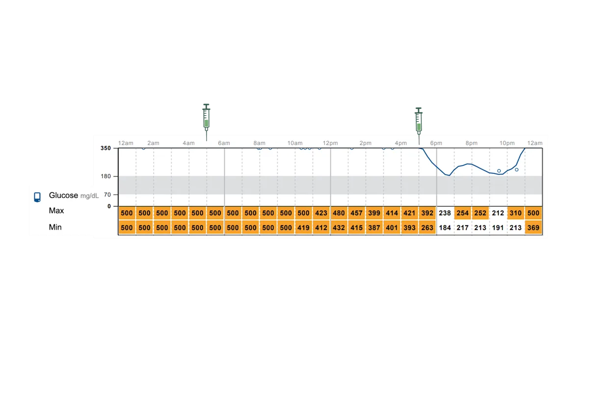 Graph showing continuous glucose monitor readings.