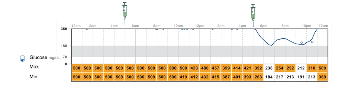 Graph showing continuous glucose monitor readings.
