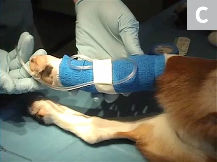 Three images demonstrating securing of catheter to skin and finished catheter placement on bandaged leg.