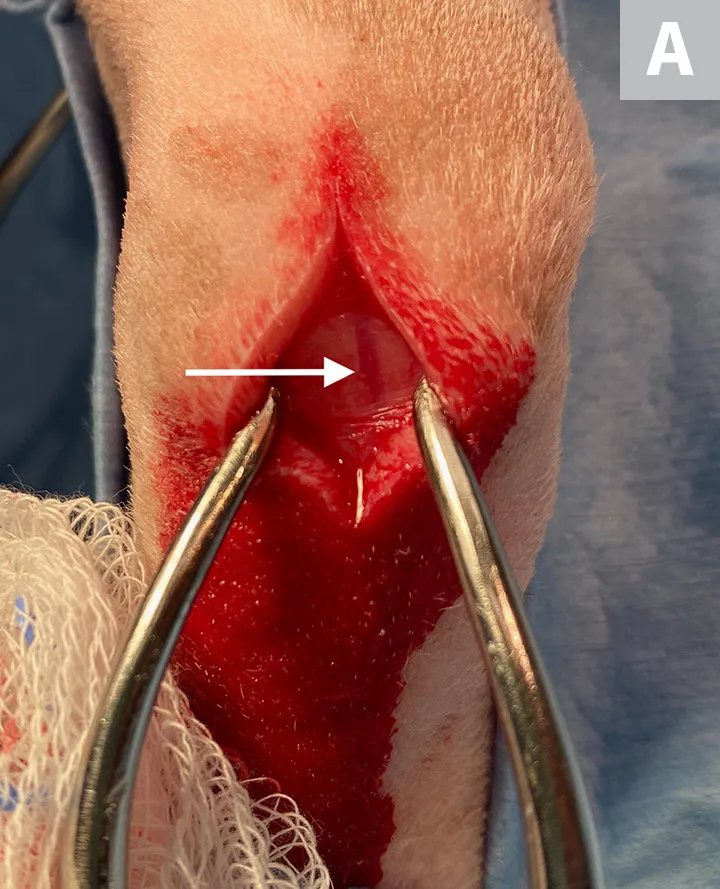 Intraoperative image showing clamps widening skin incision to expose labeled areas of interest.
