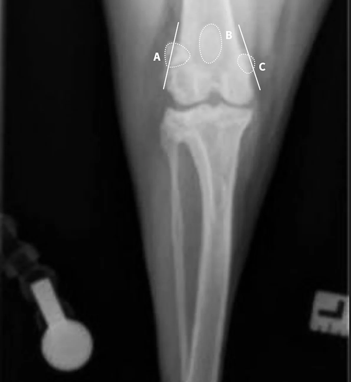 Radiographic images of a dog’s fibula and tibia.