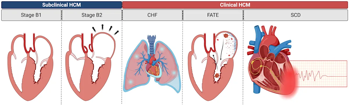 Diagrammatic representation of the subclinical phases and clinical outcomes of feline HCM
