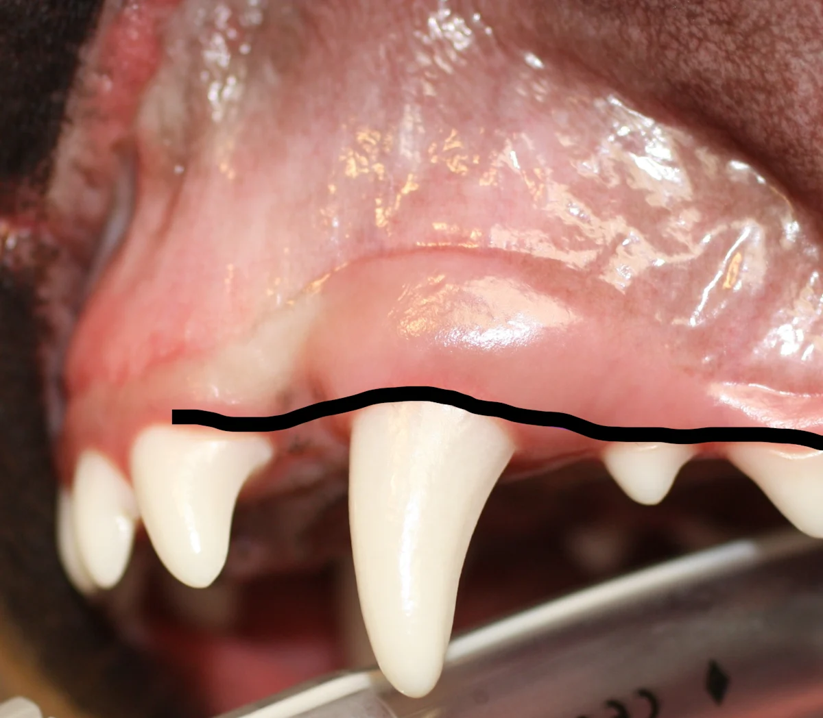 Maxillary canine tooth of a dog with solid line drawn over to indicate where to incise mucosa to create an envelope flap.