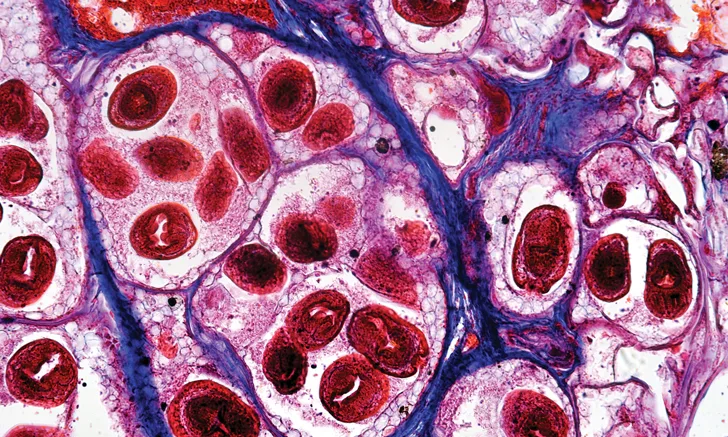 Histopathology slide of red-stained oval tapeworm larvae within hepatic cells.