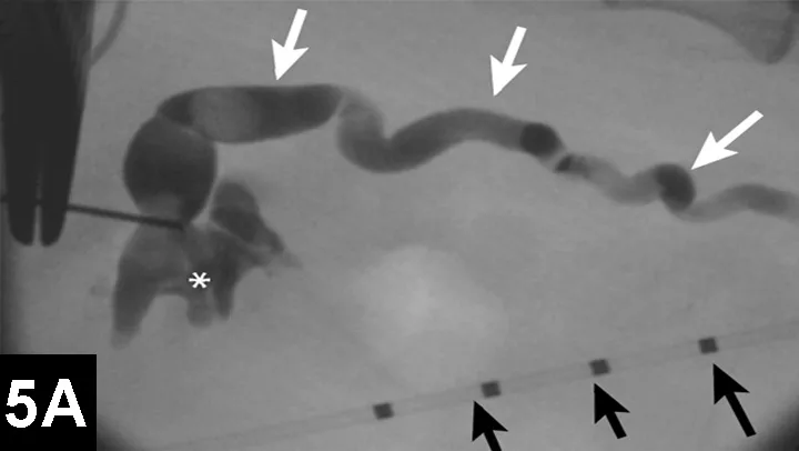 selected slide image