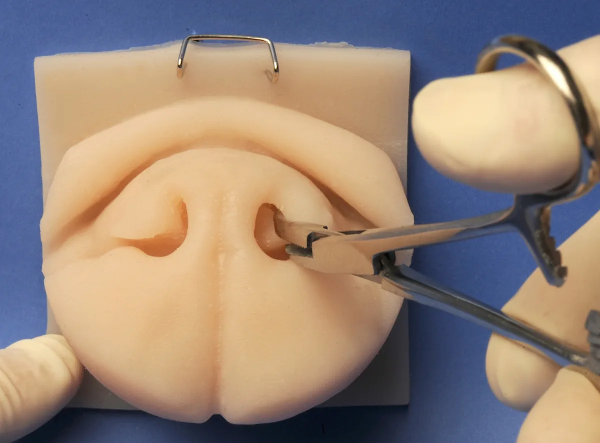 Hemostats inserted into the nares of a silicone model of a dog's nose to grasp the caudodorsal aspect of the alar fold.
