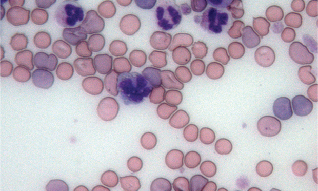 Canine Immune Mediated Hemolytic Anemia