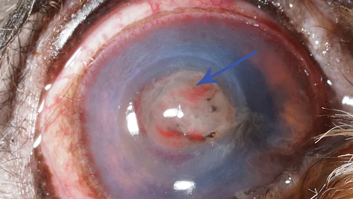Eye with circular complete corneal ulceration and arrow pointing to dense pink-white material in center of ulcer.