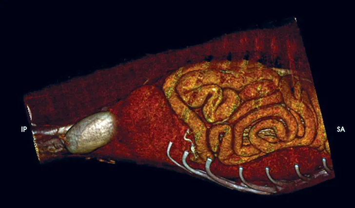 CT image of dog showing small intestines and spleen located within thoracic cavity.