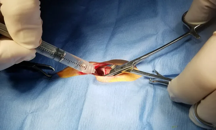 Gloved hands holding a small draped incision site open with hemostats while injecting liquid from the syringe into the incision.