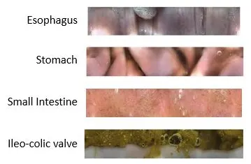 Four stacked still images showing appearance of various GI structures as captured by video capsule endoscopy.