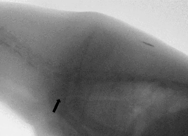 Fluoroscopic image of thoracic inlet of dog with arrow pointing to region of tracheal collapse.