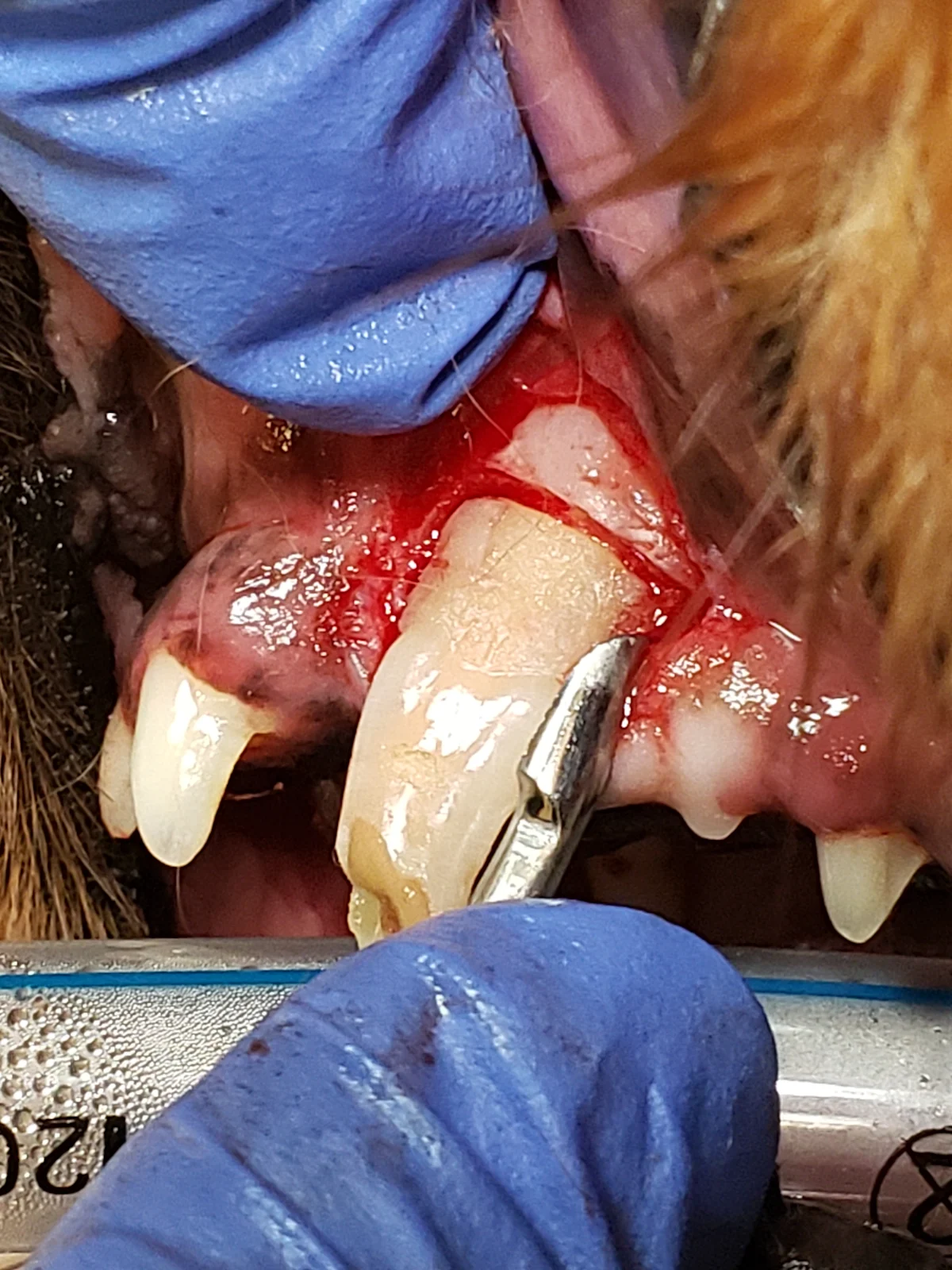 Winged dental elevator shown being inserted into periodontal ligament space around canine tooth root.