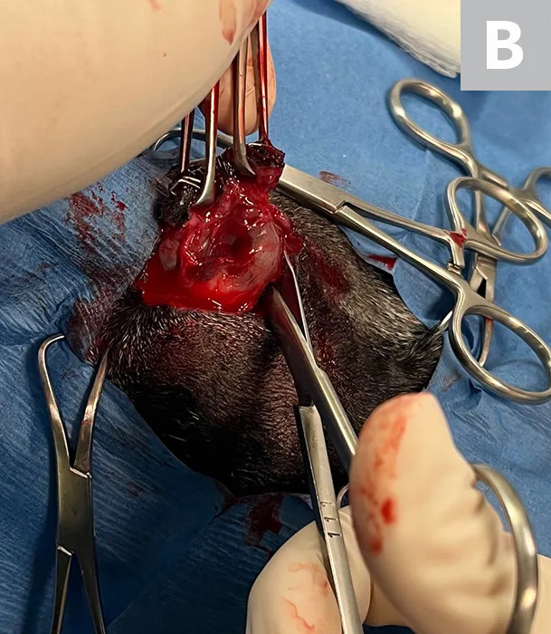 Sequence of images demonstrating deep dissection around globe of eye.