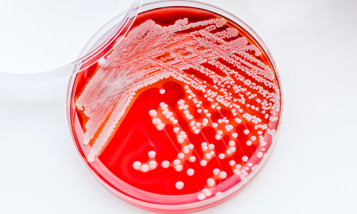 staphylococcus-pseudintermedius-an-overview