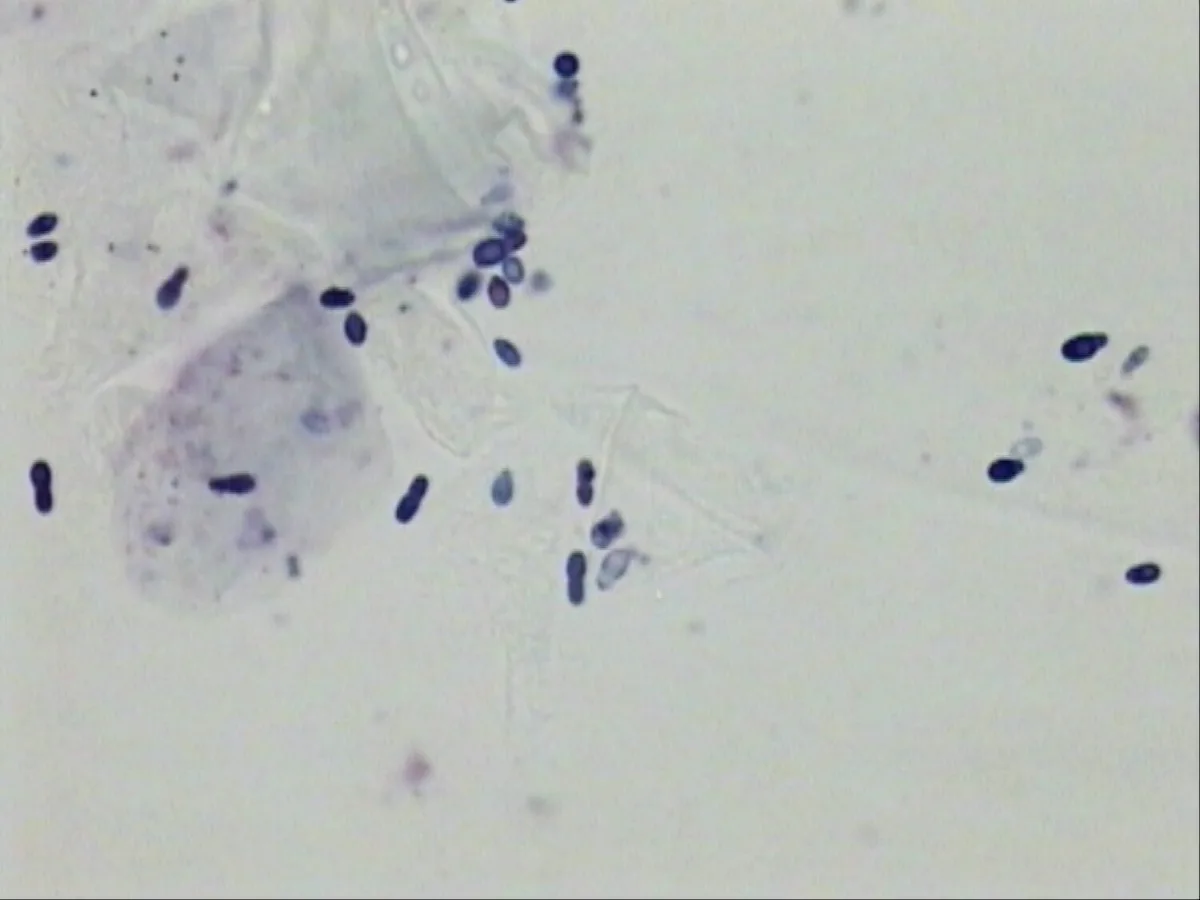 A microscopic view showing numerous oval-shaped bacterial spores scattered among cellular debris, indicating a potential bacterial infection in a veterinary sample. The background is mostly clear, highlighting the distinct morphology of the spores.