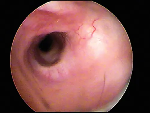 Otoscopic image of normal internal ear canal in a dog.