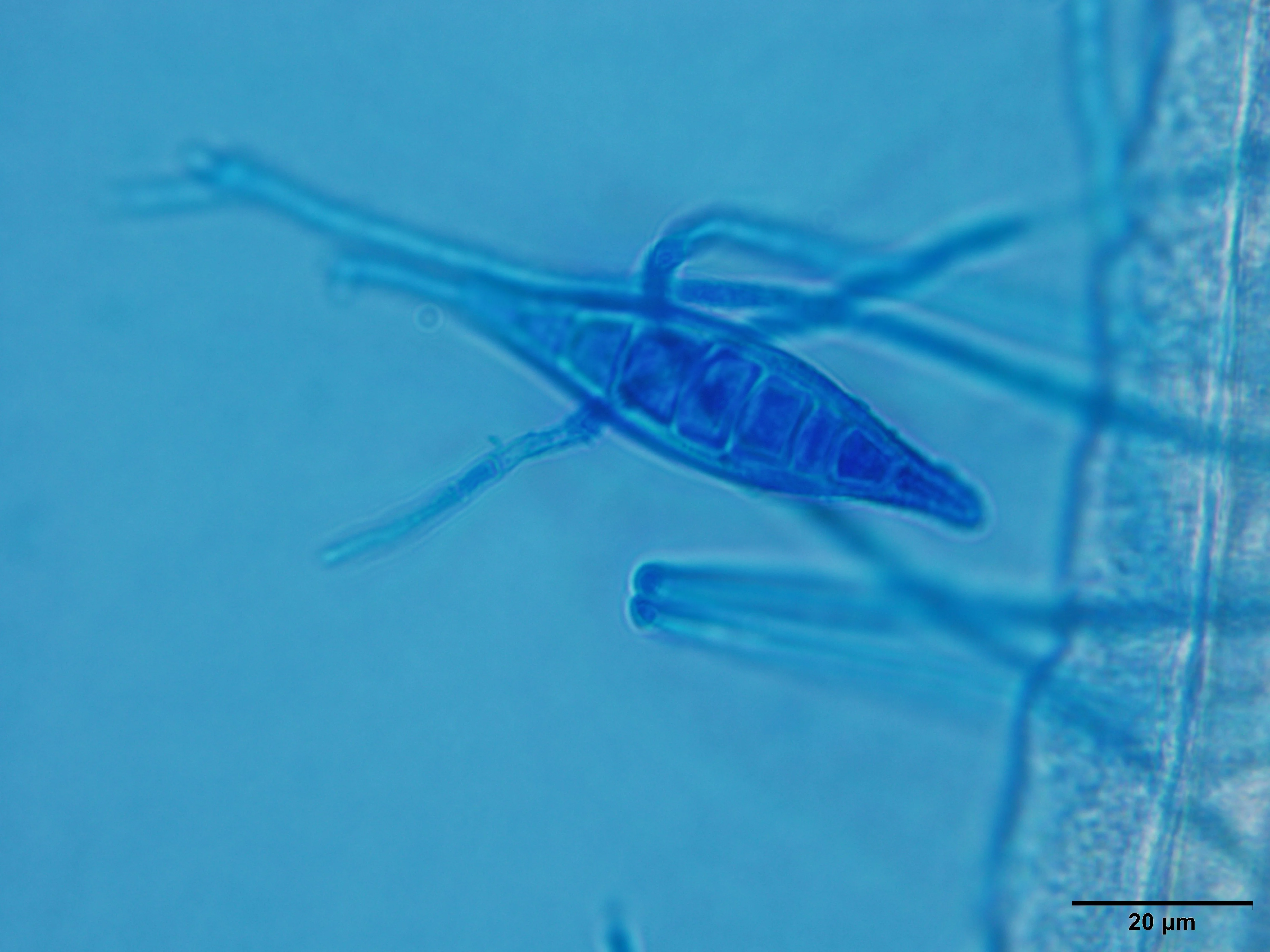 Microsporum canis macroconidia, a cause of dermatophytosis.