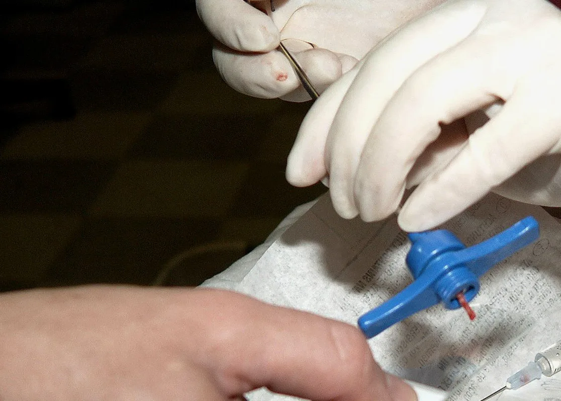 Featured Image