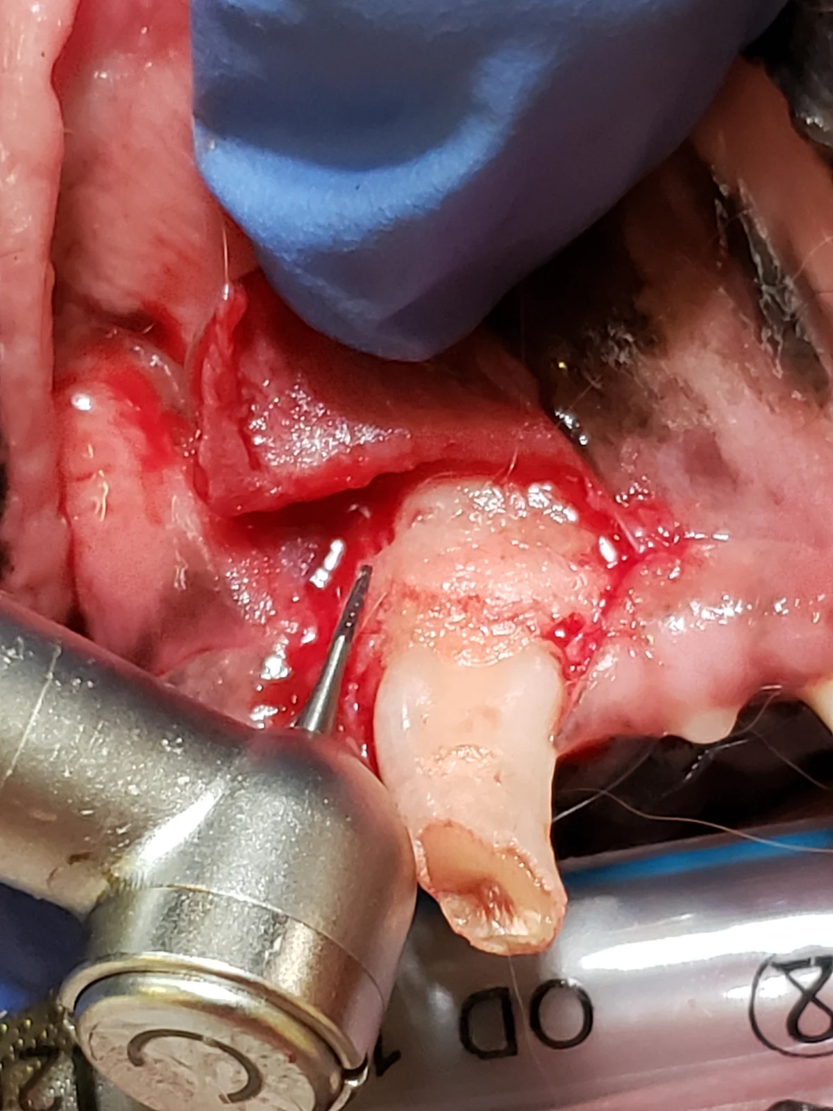 Dental bur being used to incise bone along mesial and distal edges of canine tooth root.
