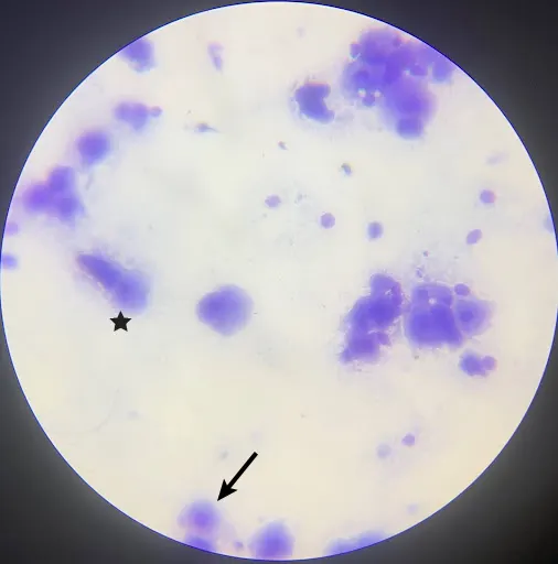 Vaginal cytology slide showing clumps of rounded nucleated cells.