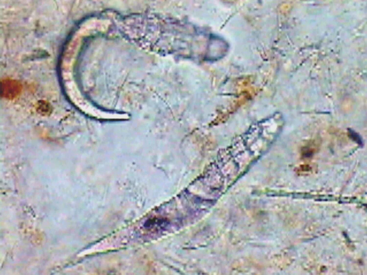 Two microscopic parasites are visible on a slide, one exhibiting a curved shape and the other elongated and slender. The background shows a textured surface, indicating a laboratory setting for veterinary diagnostics.