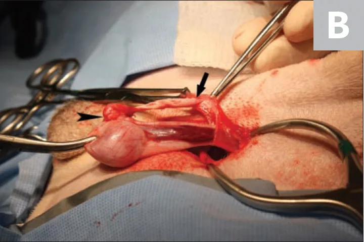 In Figure 1A, an inguinal incision has been made and the gubernaculum is being gently retracted. In Figure 1B, the cryptorchid testicle is now visible in the surgical field.