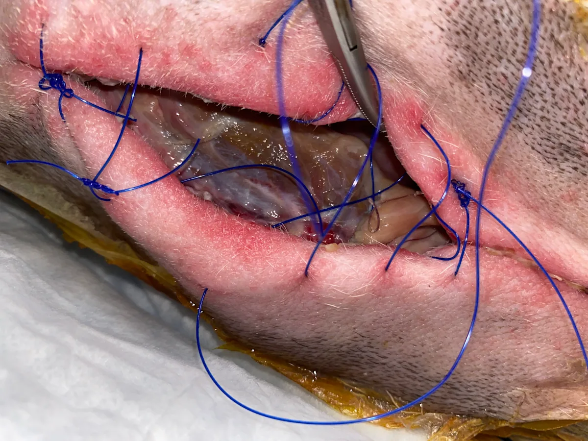 A close-up of the open incision shows discolored deeper tissues and erythematous skin.