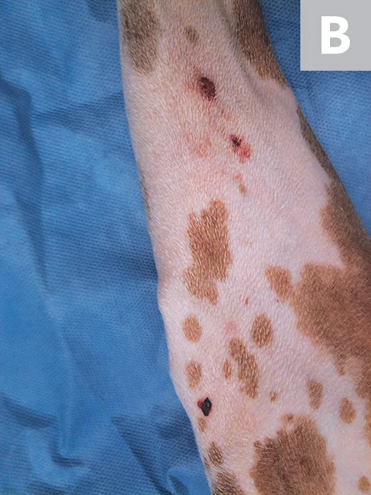A close-up view of the patient from Figure A highlighting the lesions.