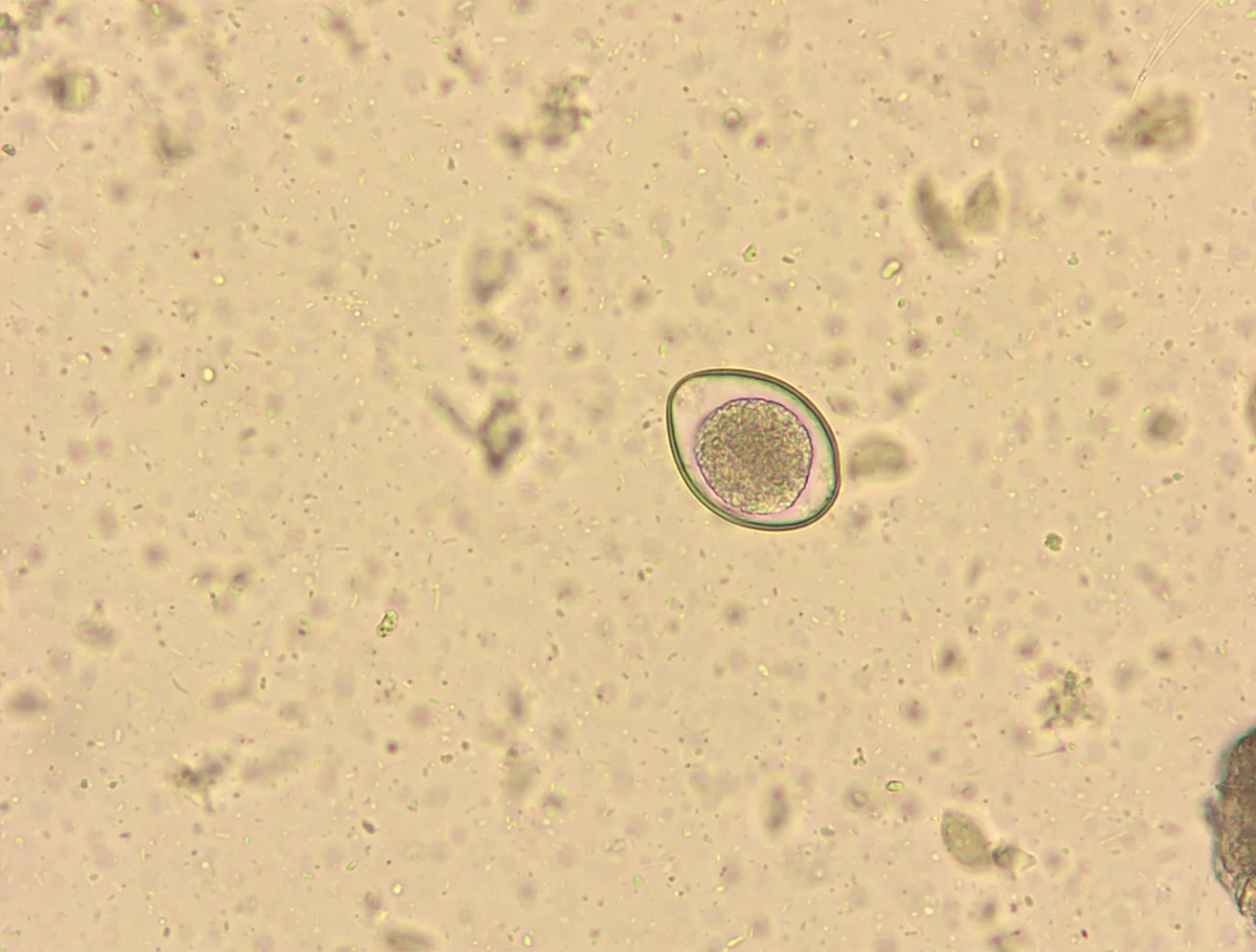 Slide showing an oocyst.