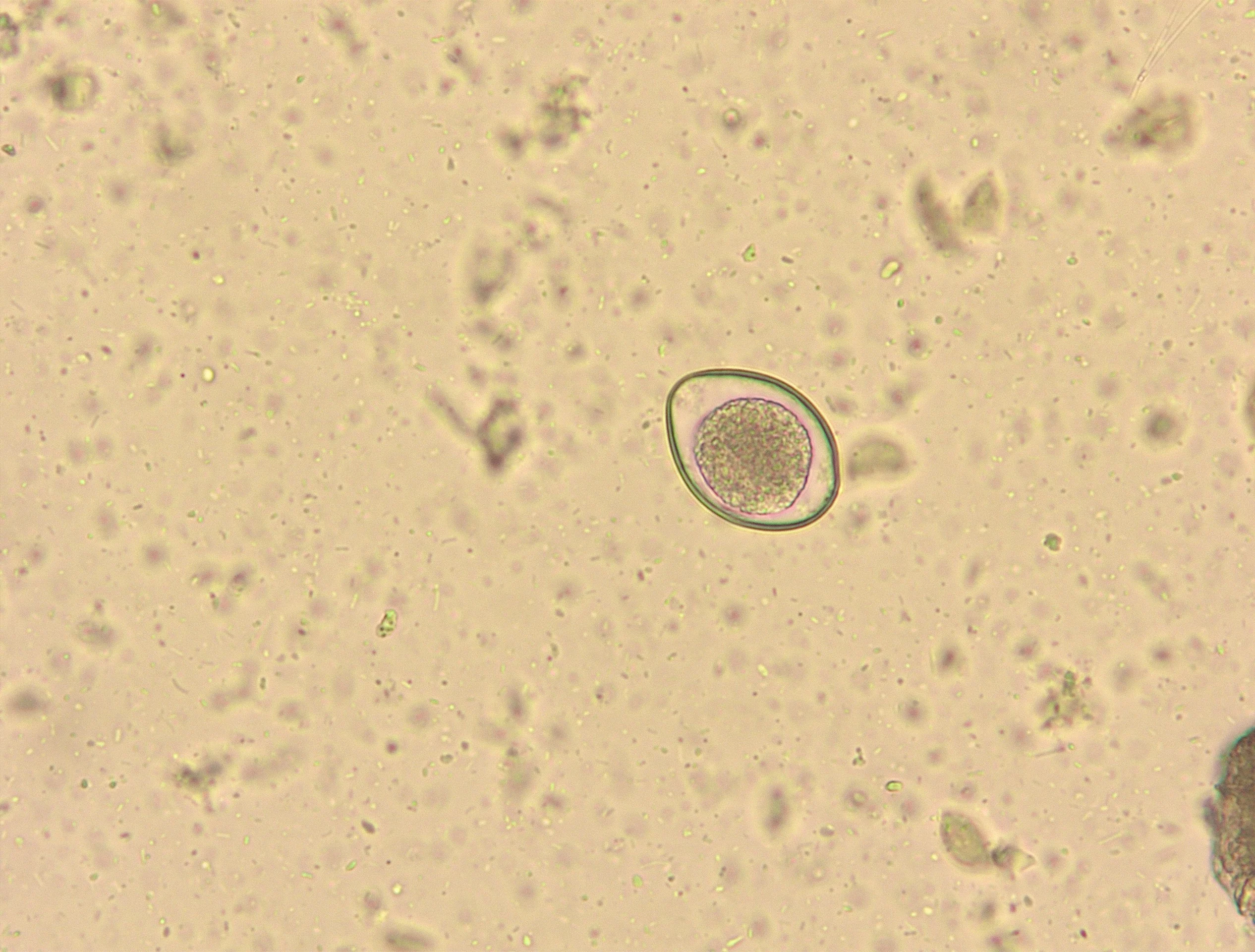 Slide showing an oocyst.