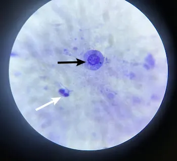 Vaginal cytology slide with arrows pointing to a round nucleated cell and a neutrophil.