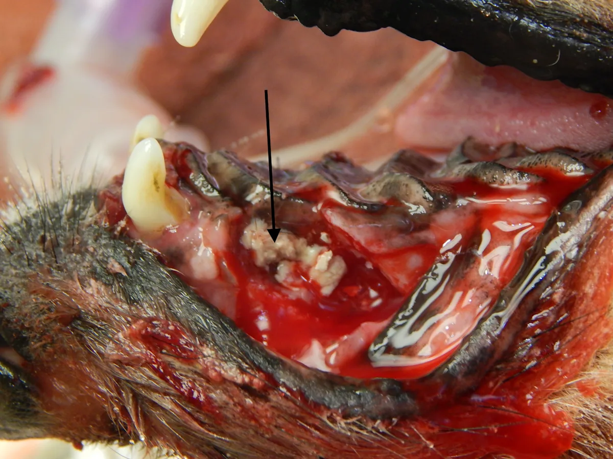 A patient’s extraction site showing copious exudate. 