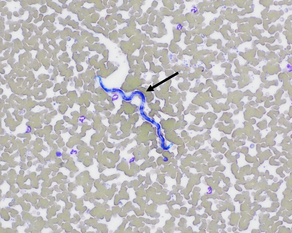Arrow pointing to a blue-stained worm seen surrounded by red and white blood cells.