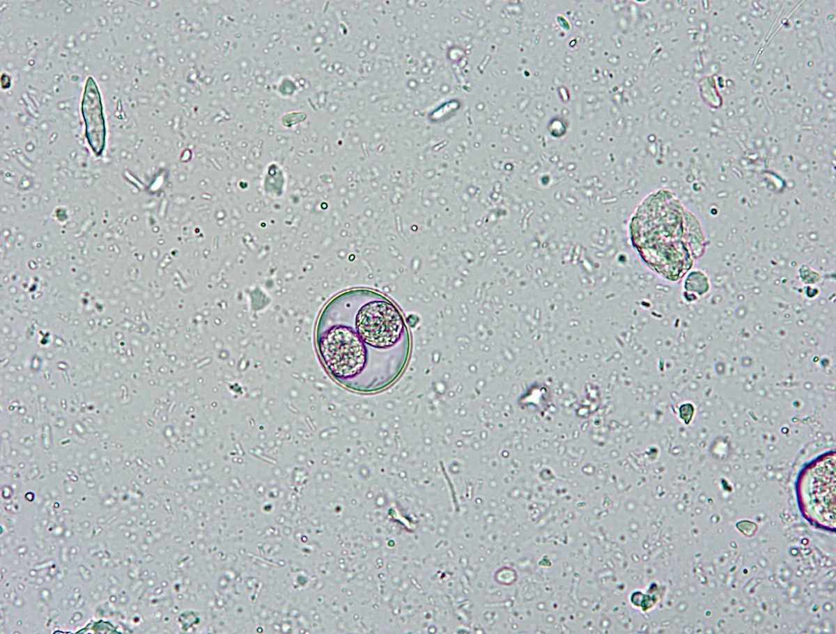 Slide showing an oocyst.