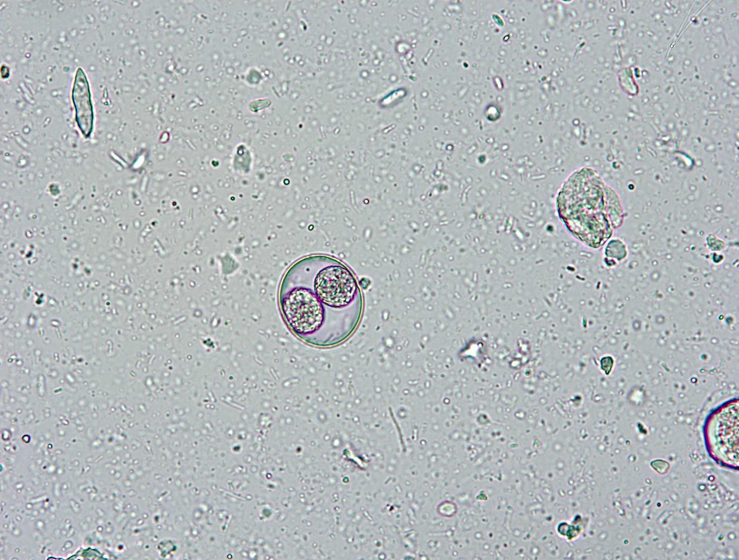 Slide showing an oocyst.