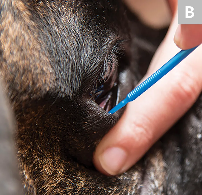 Two images demonstrating collection of corneal and conjunctival samples from eye using microbrush.