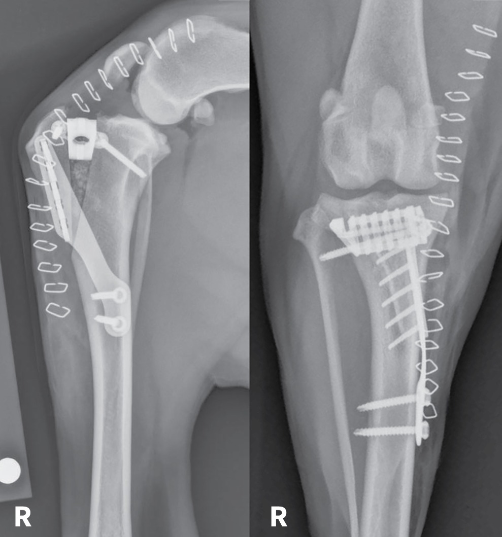 Clinical Image: What Surgical Procedure Was Performed?