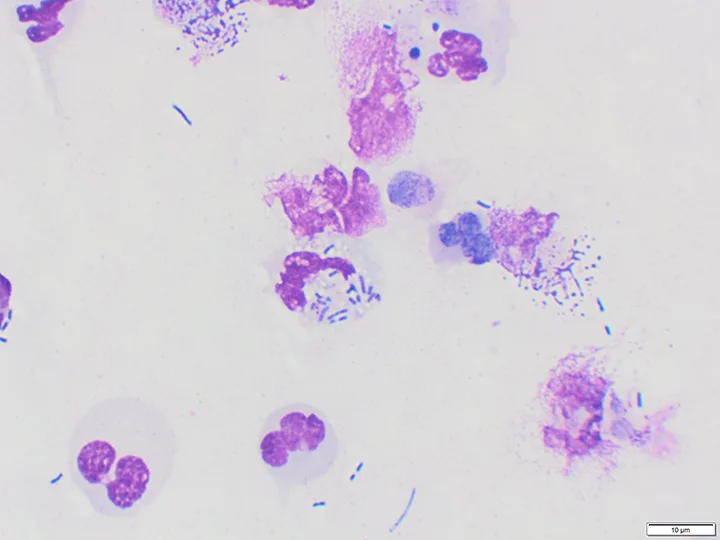 Cytology showing intracellular bacteria in white blood cells.