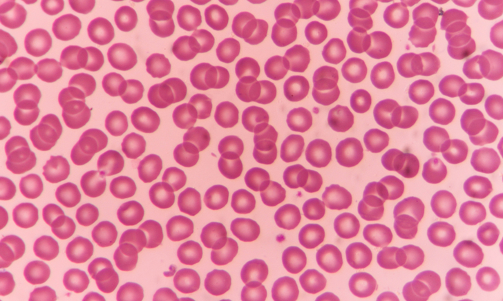 Anemia in Animals Differential Diagnoses