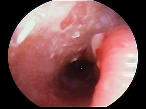 selected slide image