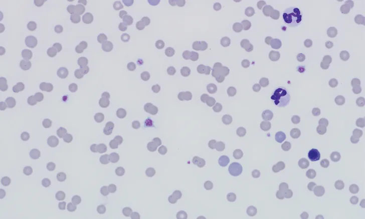 Stained cytology image of a feline blood smear showing red blood cells and Mycoplasma haemofelis bacteria. 
