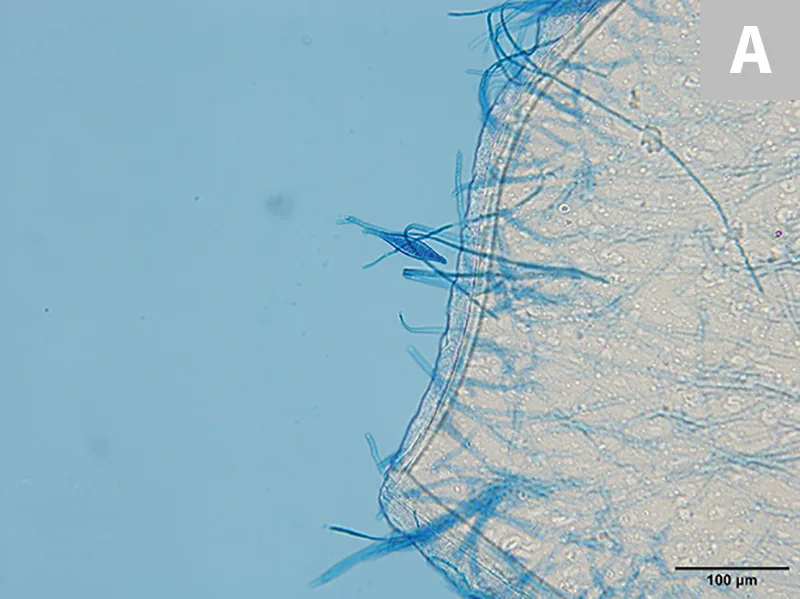 Cytologic appearance of M canis macroconidia at 2 different magnifications.