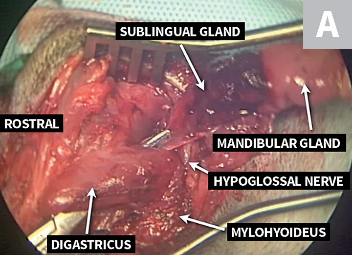 Side-by-side intraoperative images showing labeled relevant anatomic structures in region of salivary gland.
