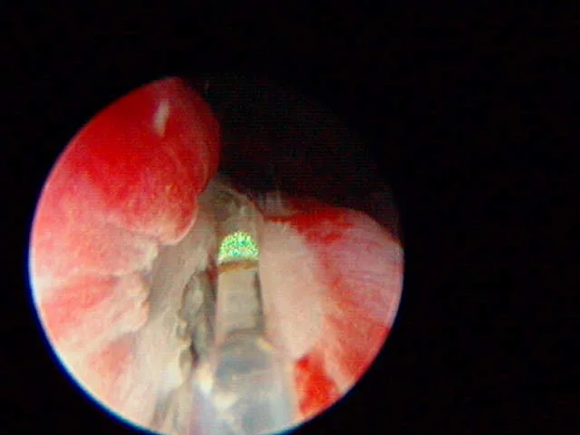 selected slide image