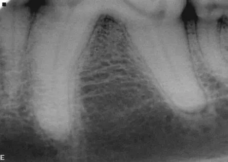 A dental radiograph showing the roots of a canine tooth, highlighting the surrounding bone structure and periodontal tissues. The image reveals details of the root canal system and any potential signs of dental disease or abnormalities.