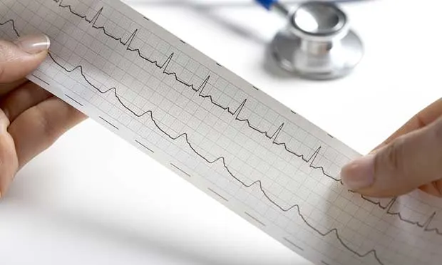 A veterinary team member’s hands holding a printed ECG strip.